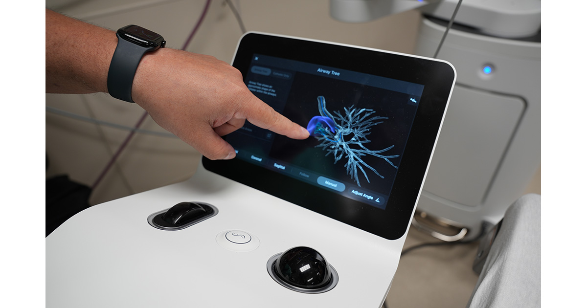 https://news.sphp.com/wp-content/uploads/2026/07/Bronchoscopy-fb.jpg